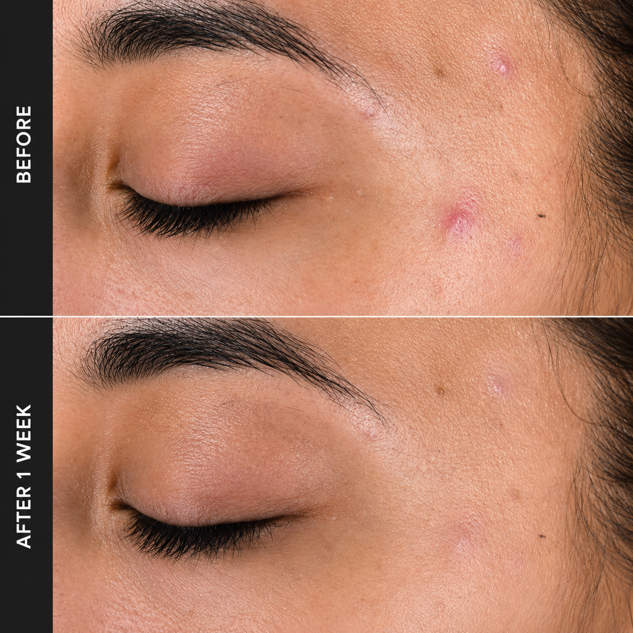 2% BHA Liquid Exfoliant