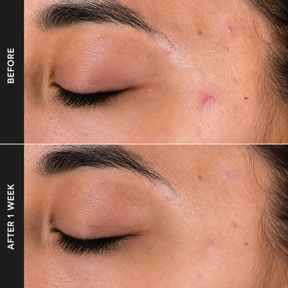 2% BHA Liquid Exfoliant